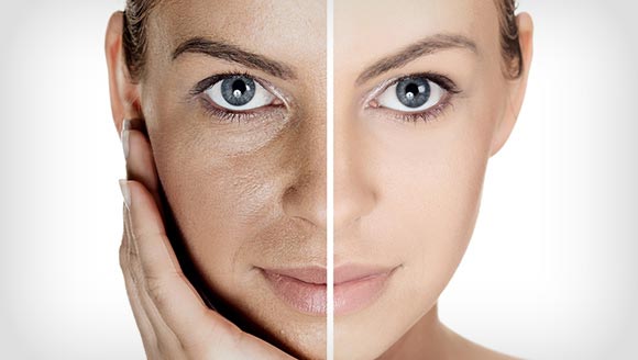 Face rejuvenation